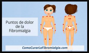Fibromialgia Puntos Dolorosos